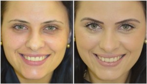 Micro pigmentação Corretiva para Sobrancelhas